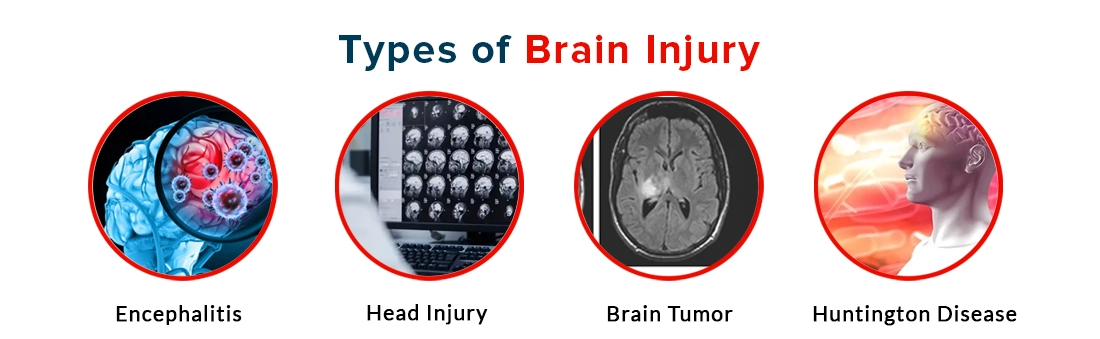 Types of Brain Injury